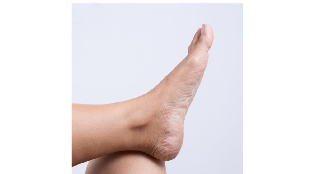 Location of Taixi KI-3 between the inner ankle bone and the Achilles tendon